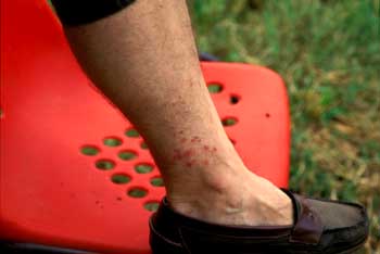 do potato bugs bite do potato bugs bite